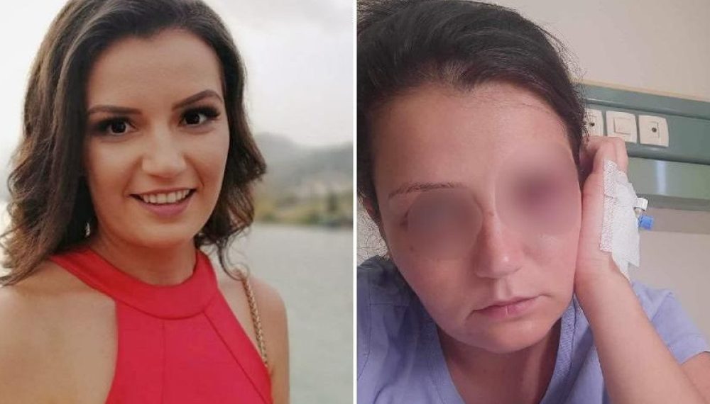 Agencija za ravnopravnost spolova BiH – Kazniti počinitelja nasilja nad uposlenicom hotela ‘Jablanica’